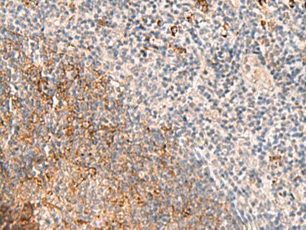 Anti-AGAP4 Rabbit Polyclonal Antibody