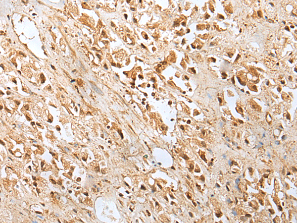Anti-E2F8 Rabbit Polyclonal Antibody