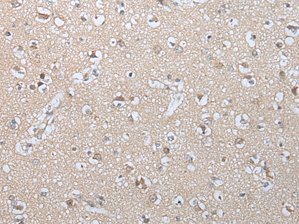 Anti-GZMM Rabbit Polyclonal Antibody