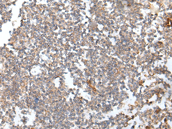 Anti-HOXB6 Rabbit Polyclonal Antibody