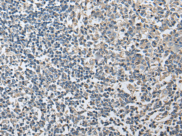 Anti-PLA2G16 Rabbit Polyclonal Antibody