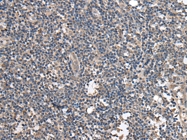 Anti-BRI3BP Rabbit Polyclonal Antibody
