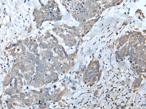 Anti-Ephrin B3 Rabbit Polyclonal Antibody