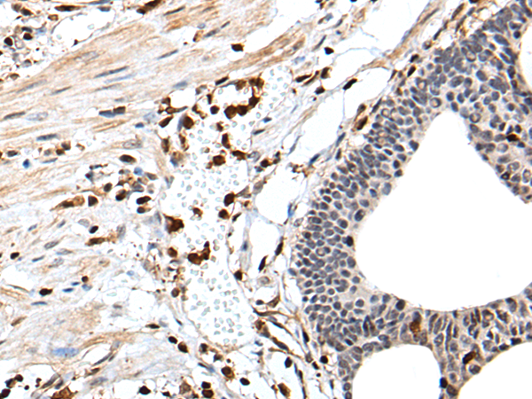 Anti-D4 GDI Rabbit Polyclonal Antibody