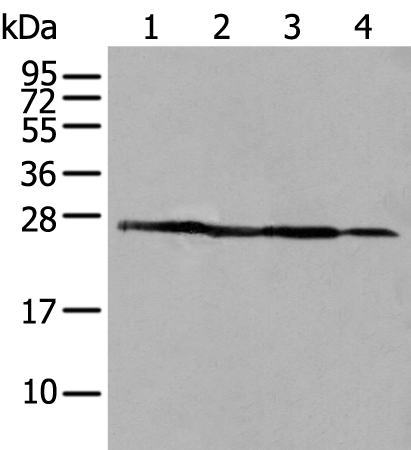 Anti-D4 GDI Rabbit Polyclonal Antibody