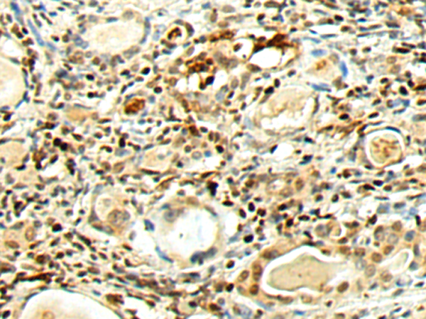 Anti-PTOV1 Rabbit Polyclonal Antibody