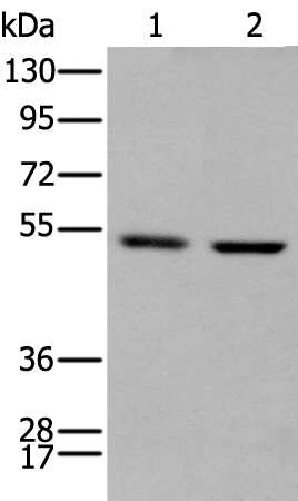 Anti-PTOV1 Rabbit Polyclonal Antibody