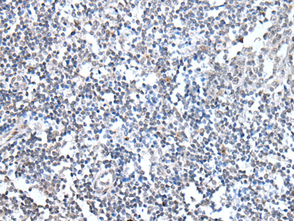 Anti-Menin Rabbit Polyclonal Antibody