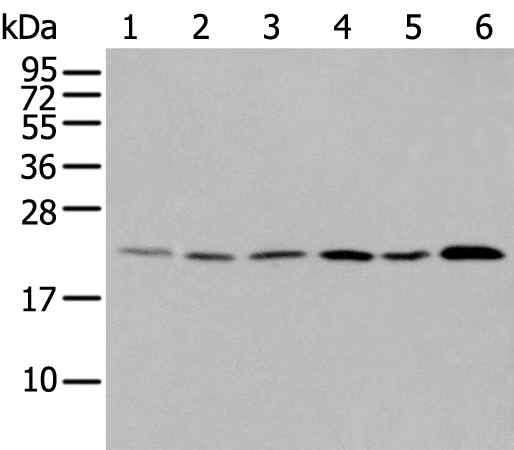 Anti-DUSP3 Rabbit Polyclonal Antibody