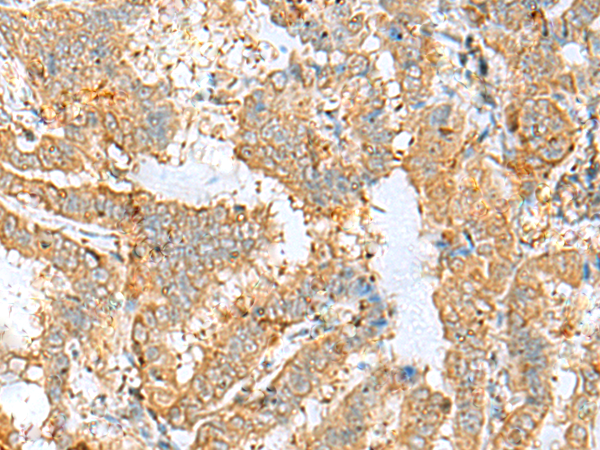 Anti-LGALS9 Rabbit Polyclonal Antibody
