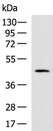 Anti-LGALS9 Rabbit Polyclonal Antibody