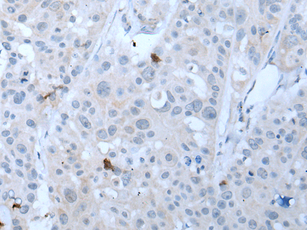 Anti-GKN1 Rabbit Polyclonal Antibody
