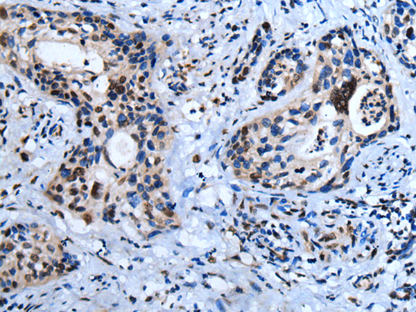 Anti-HOXD10 Rabbit Polyclonal Antibody