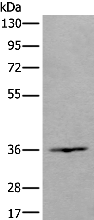 Anti-HOXD10 Rabbit Polyclonal Antibody