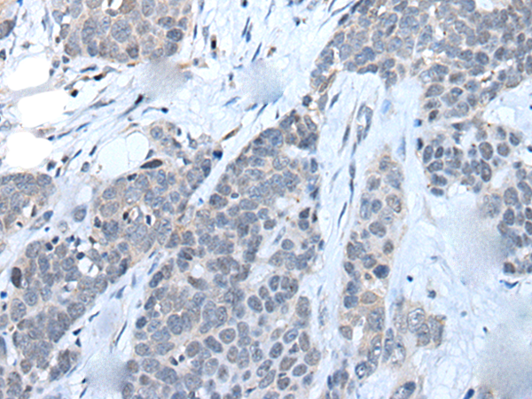 Anti-LILRB5 Rabbit Polyclonal Antibody