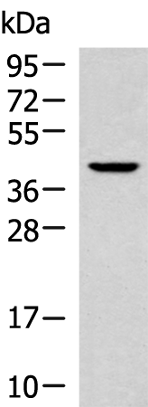 Anti-KLF6 Rabbit Polyclonal Antibody