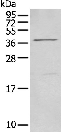 Anti-MAGEB18 Rabbit Polyclonal Antibody