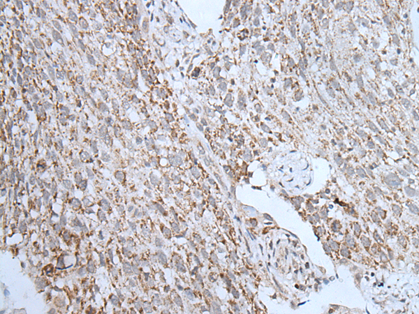 Anti-hCG receptor/LHR Rabbit Polyclonal Antibody