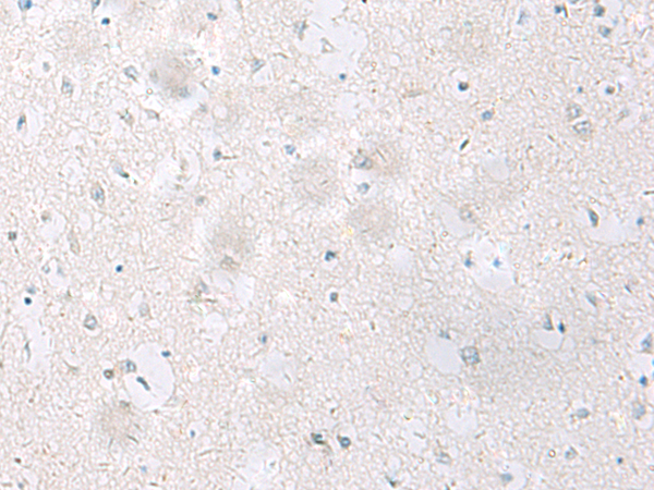 Anti-SST Rabbit Polyclonal Antibody