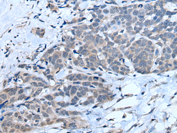 Anti-MTHFR Rabbit Polyclonal Antibody