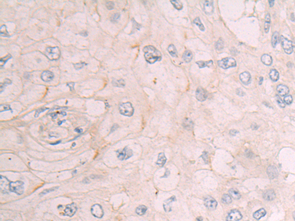 Anti-DHHC5 Rabbit Polyclonal Antibody