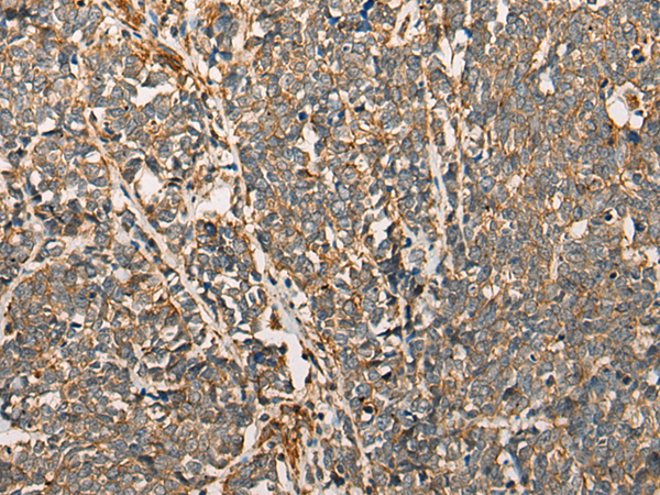 Anti-MYL12B Rabbit Polyclonal Antibody