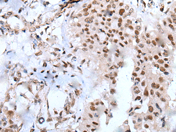 Anti-XAB2 Rabbit Polyclonal Antibody