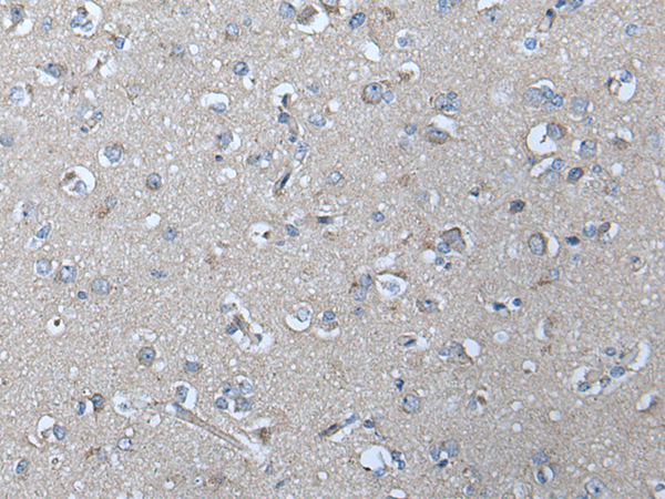 Anti-VRK2 Rabbit Polyclonal Antibody