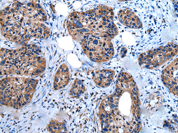 Anti-UGGT1 Rabbit Polyclonal Antibody