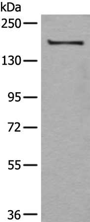 Anti-UGGT1 Rabbit Polyclonal Antibody