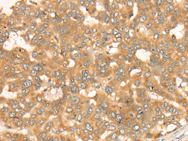 Anti-BAGE2 Rabbit Polyclonal Antibody
