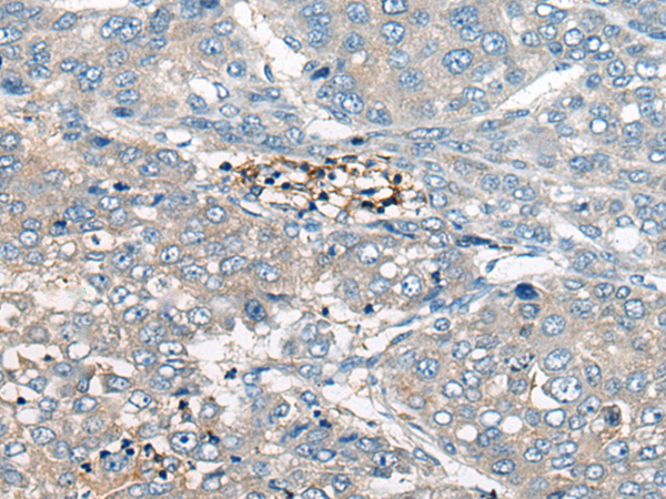 Anti-BASP1 Rabbit Polyclonal Antibody