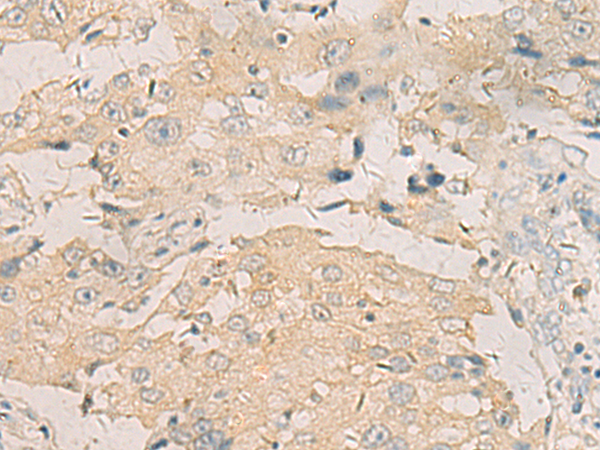 Anti-beta IIA Tubulin Rabbit Polyclonal Antibody