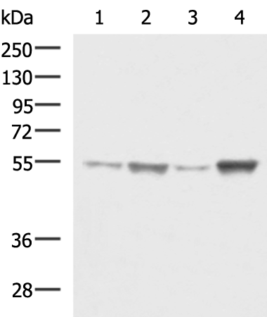 Anti-beta IIA Tubulin Rabbit Polyclonal Antibody