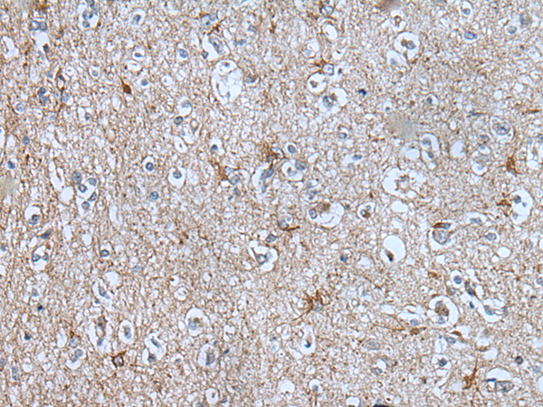 Anti-BMP1 Rabbit Polyclonal Antibody