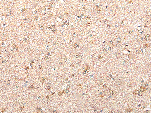 Anti-Cytochrome P450 11B2 Rabbit Polyclonal Antibody