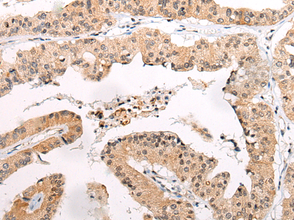 Anti-CHAMP1 Rabbit Polyclonal Antibody