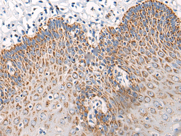 Anti-ATP5MPL Rabbit Polyclonal Antibody