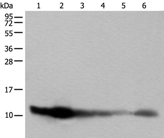 Anti-ATP5MPL Rabbit Polyclonal Antibody