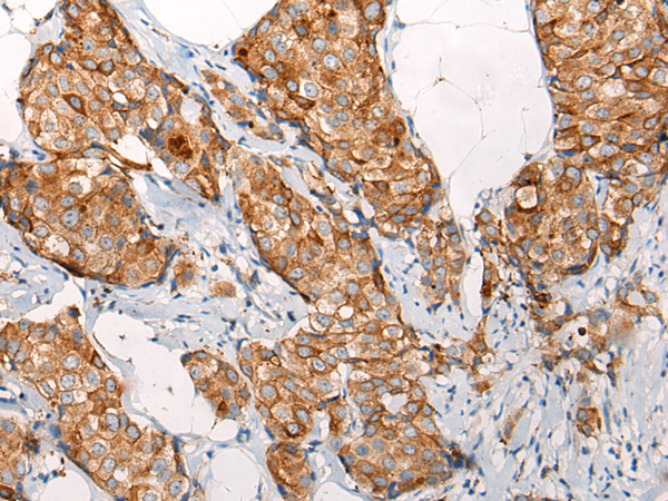 Anti-EMC7 Rabbit Polyclonal Antibody