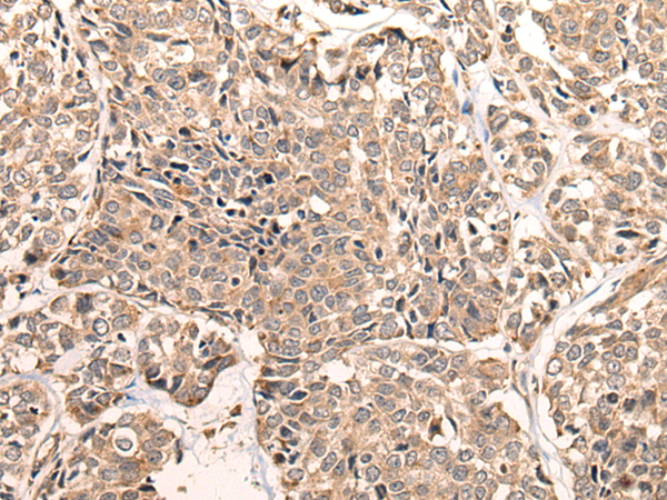 Anti-LDAH Rabbit Polyclonal Antibody