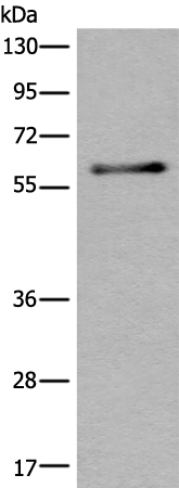 Anti-CACNB4 Rabbit Polyclonal Antibody
