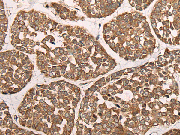 Anti-CAD Rabbit Polyclonal Antibody