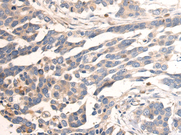 Anti-Calpain 14 Rabbit Polyclonal Antibody