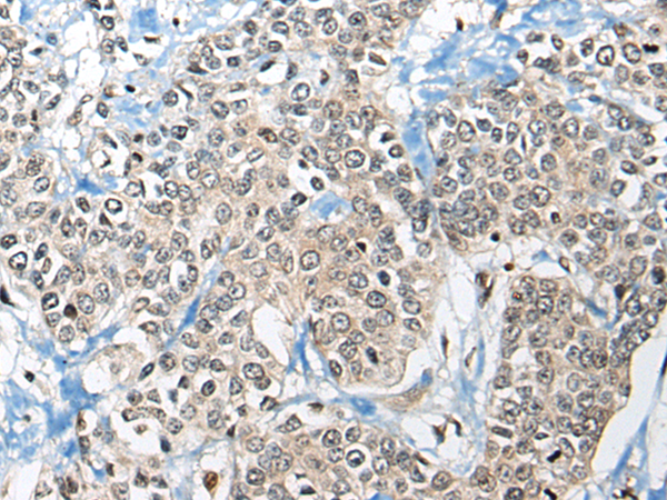 Anti-CEBPZ Rabbit Polyclonal Antibody