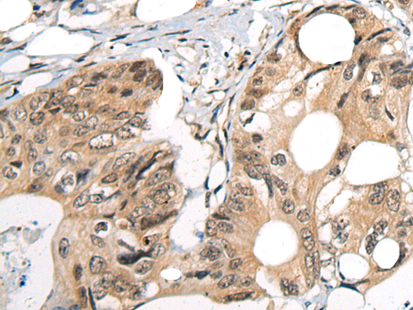 Anti-CDKL2 Rabbit Polyclonal Antibody