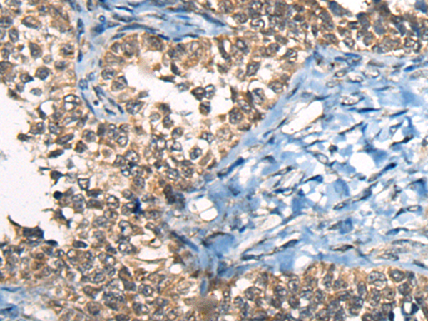 Anti-CDKL4 Rabbit Polyclonal Antibody
