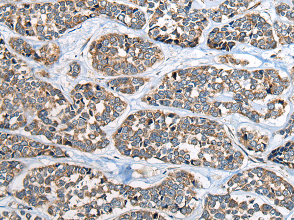 Anti-Cell Adhesion Molecule 2 Rabbit Polyclonal Antibody