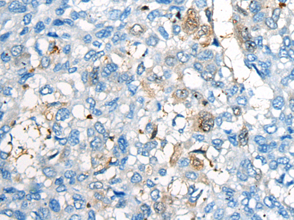 Anti-CEP170 Rabbit Polyclonal Antibody