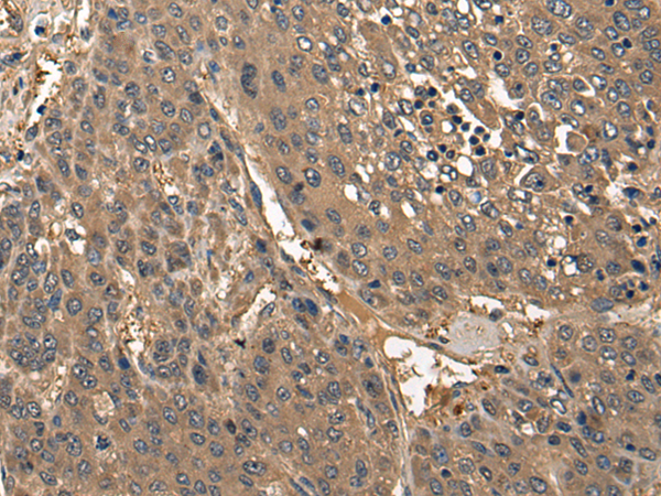 Anti-Collagen XXV alpha 1 Rabbit Polyclonal Antibody